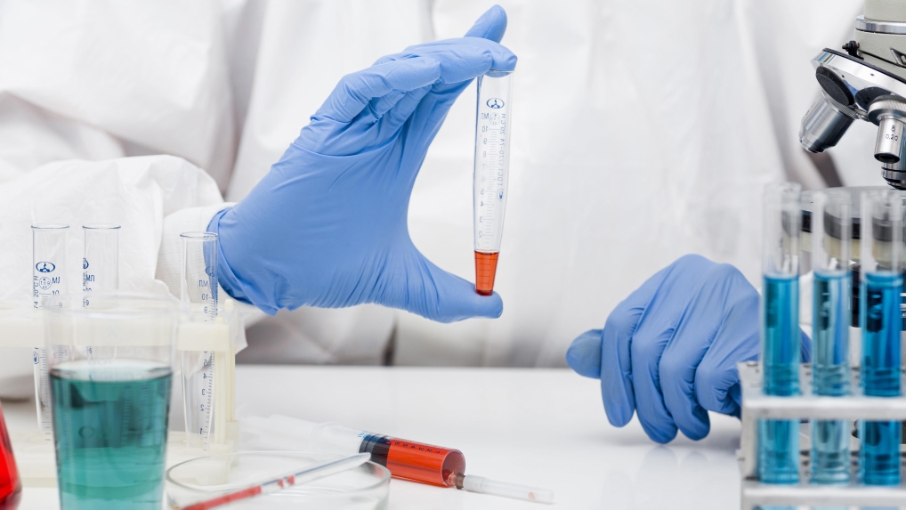 تخطيط تجربة علميّة مضبوطة